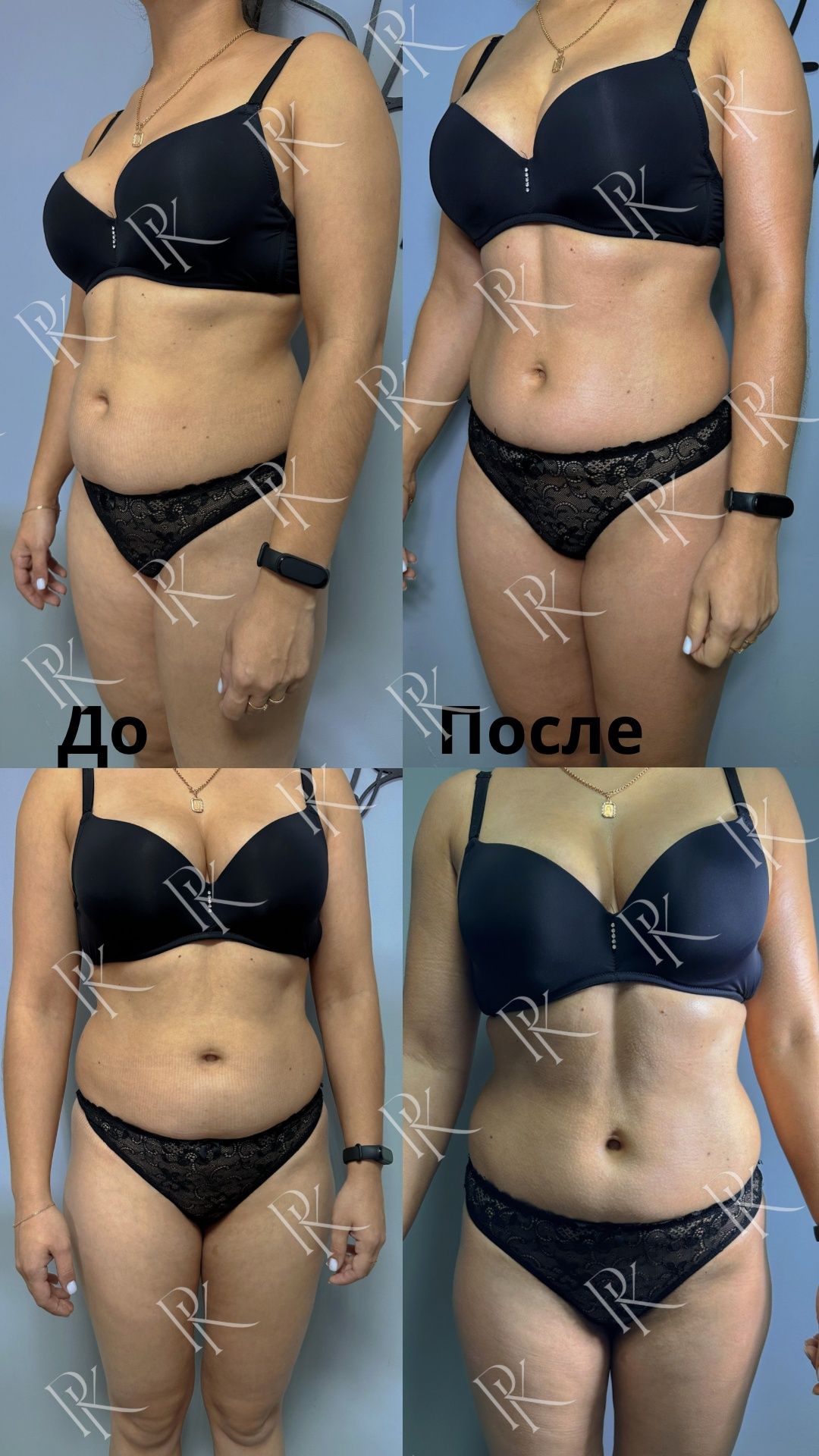 Бандажне обгортання,  антицелюлітний масаж,  спа- догляд