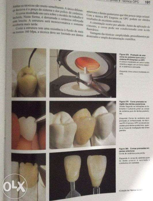 Odontologia Estetica-Atlas colorido