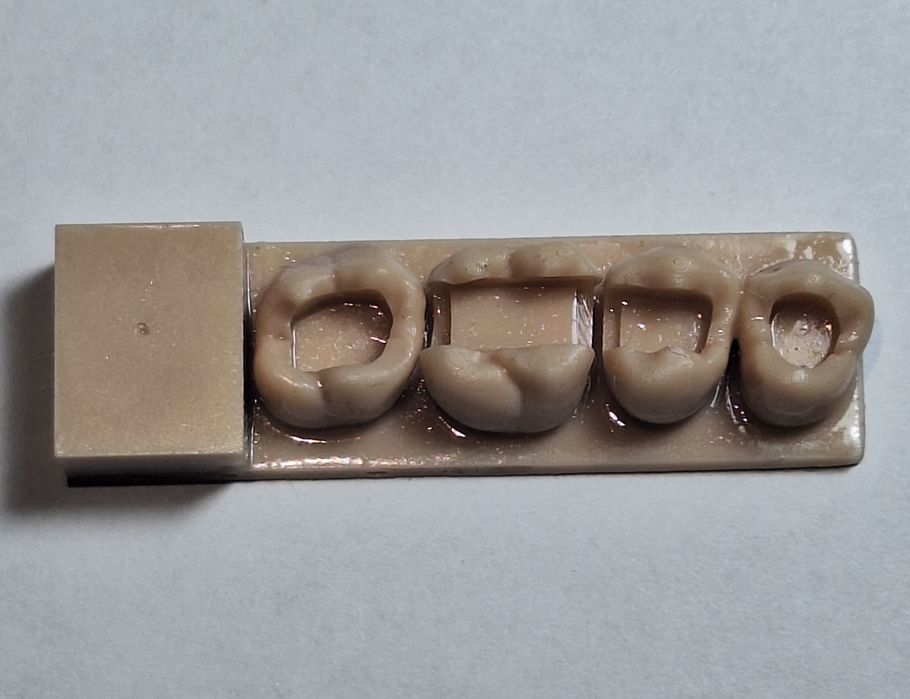 Нова 3D-модель для покращення навику прямої реставрації, фантом