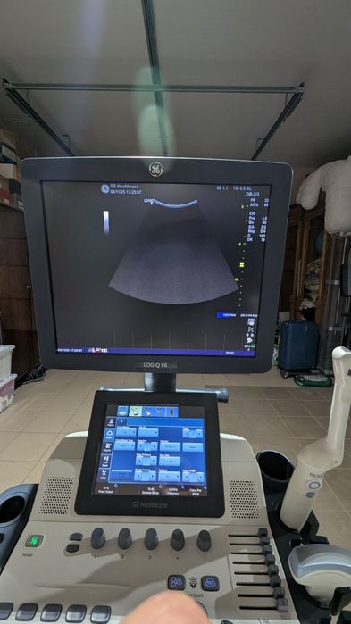 Продаю аппарат узи, узд