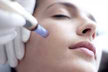 Szkolenie kurs Mezoterapia MIKROIGŁOWA dermapen, IGŁOWA , LIPOLIZA