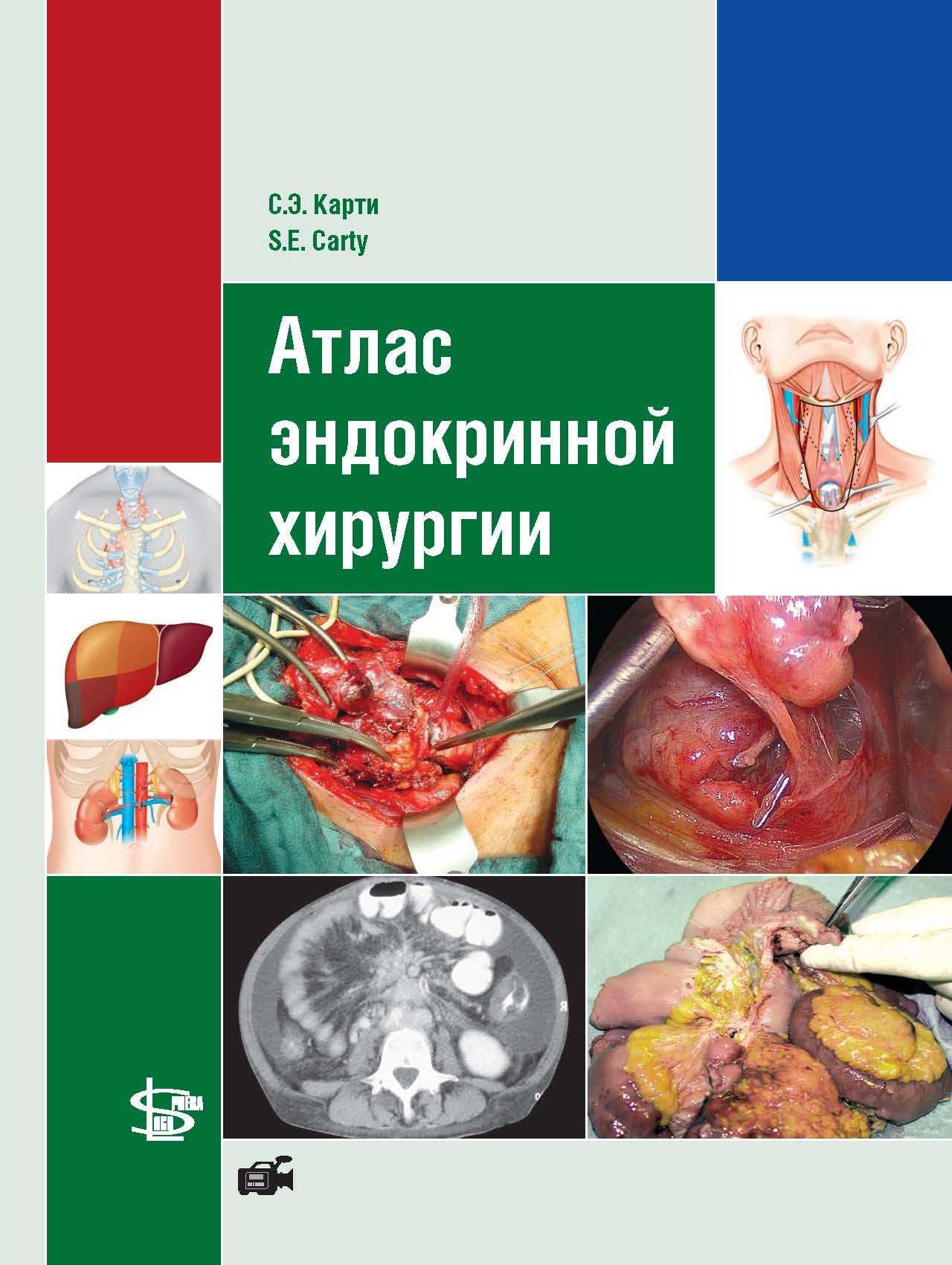 Атлас эндокринной хирургии