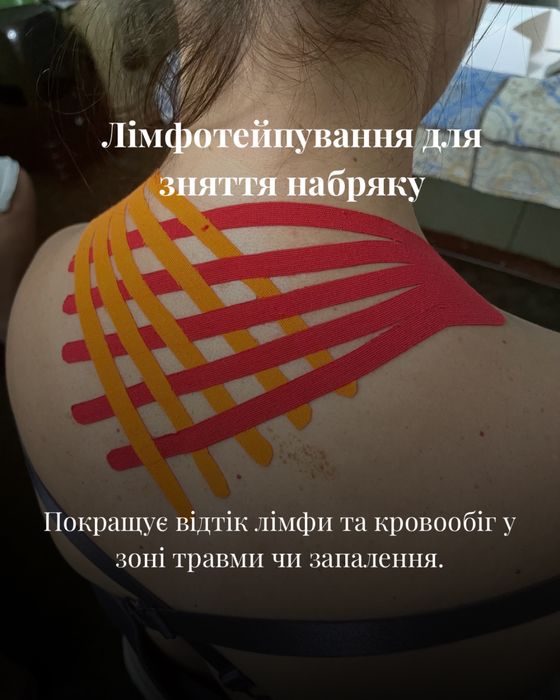 Масаж  Запоріжжя