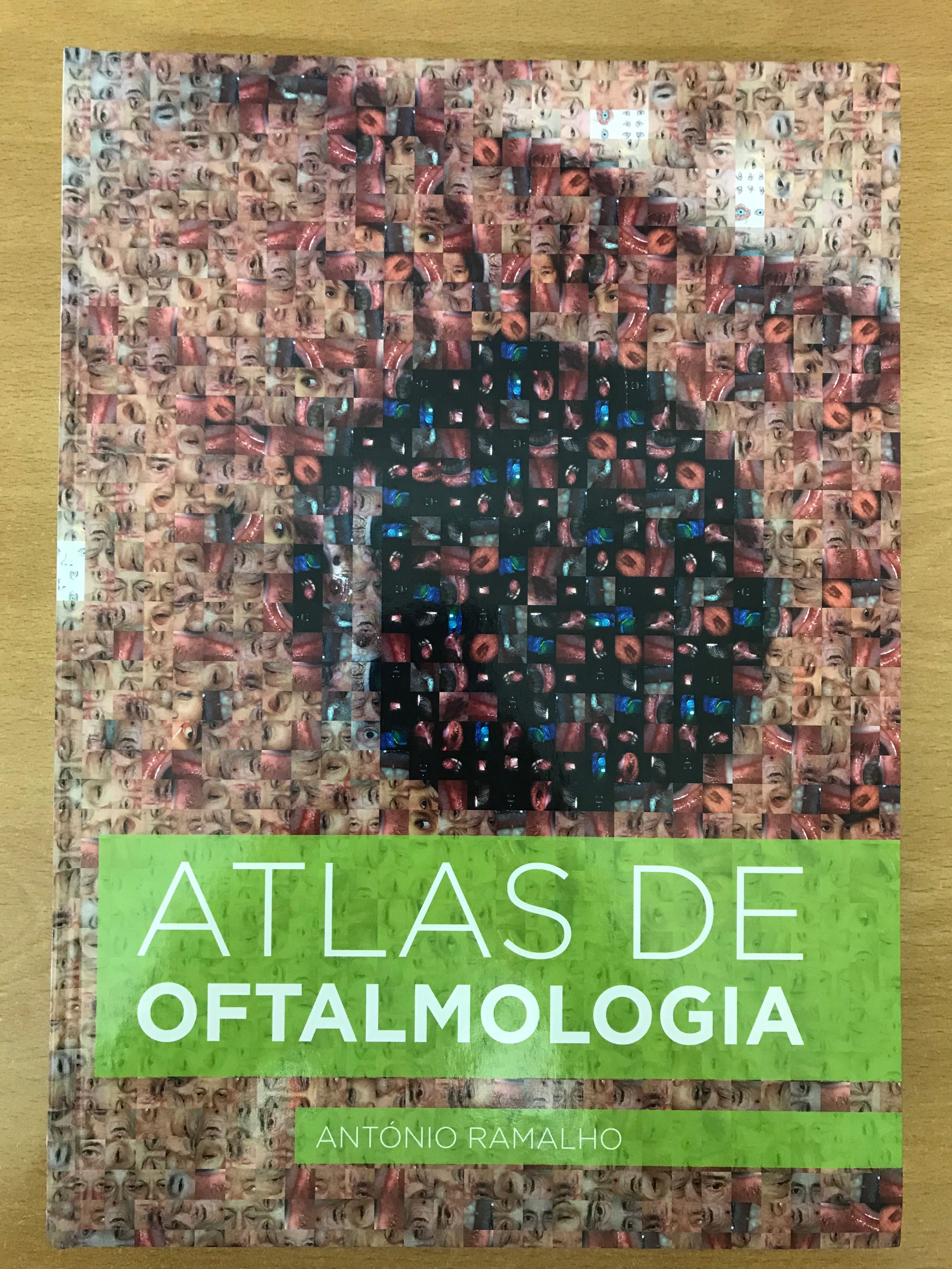 Atlas de Oftalmologia