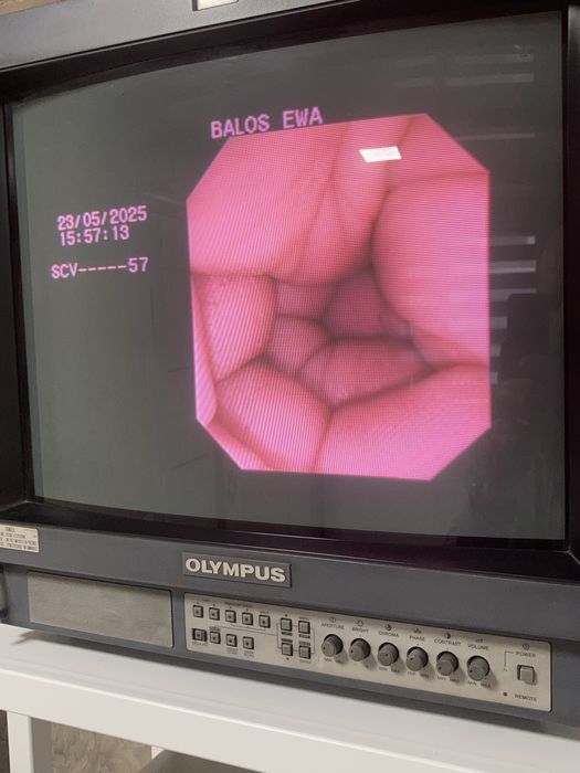 Ендоскоп гастроскоп стійка Олімпус