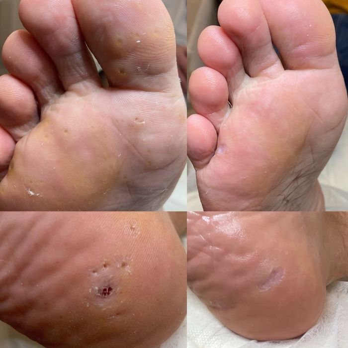 Подолог. Медичний педикюр