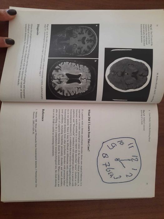 Neuropsychiatry Case Studies - 1st ed - LIVRO MEDICINA NOVO