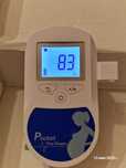 Доплер Contec Baby Sound C1 датчик 3 МГц із записом
