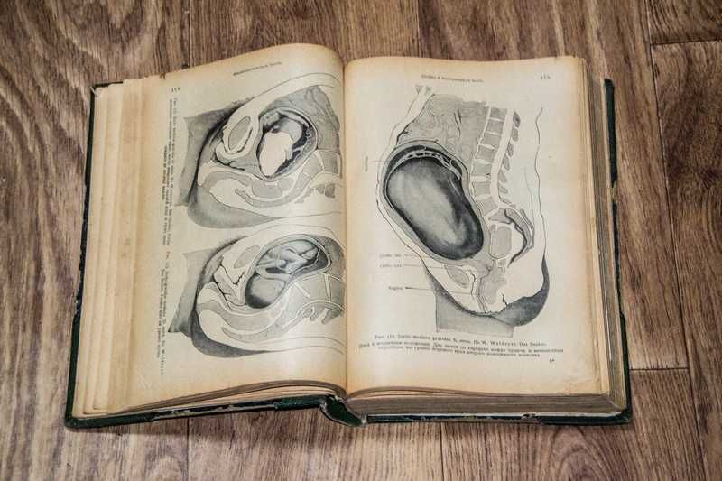Книга "Акушерство" проф. Эрнст Бумм  1924 г
