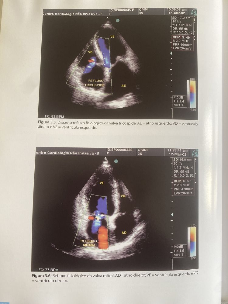 O Ecocardiograma no Apoio à Decisão Clinica