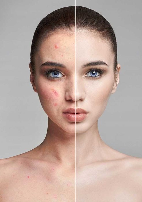 Peeling Kawitacyjny do Twarzy Ultradźwiękowy 5w1
