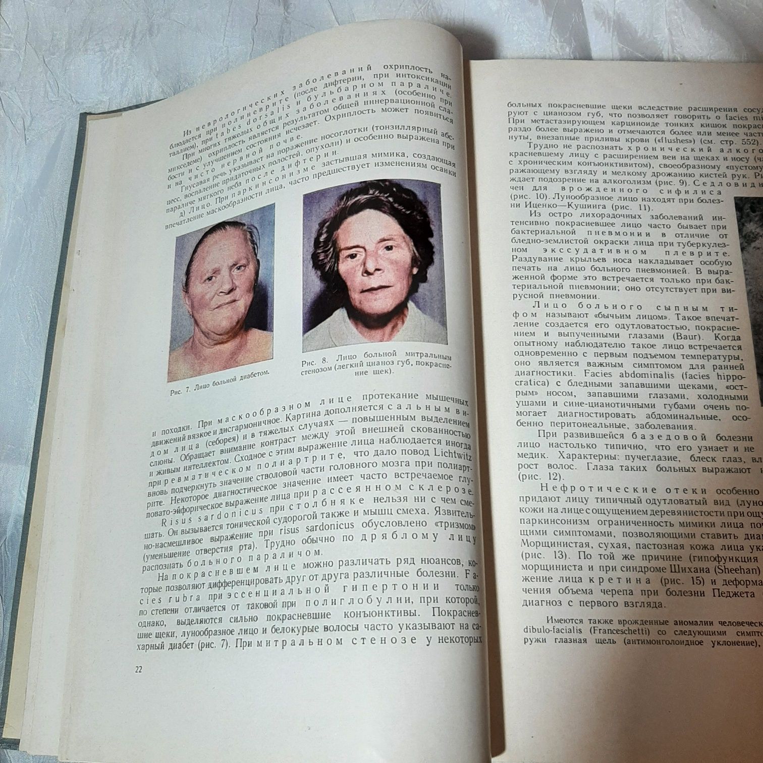 "Дифференциальная диагностика внутренних болезней" Р.Хегглин 1965 г.в.