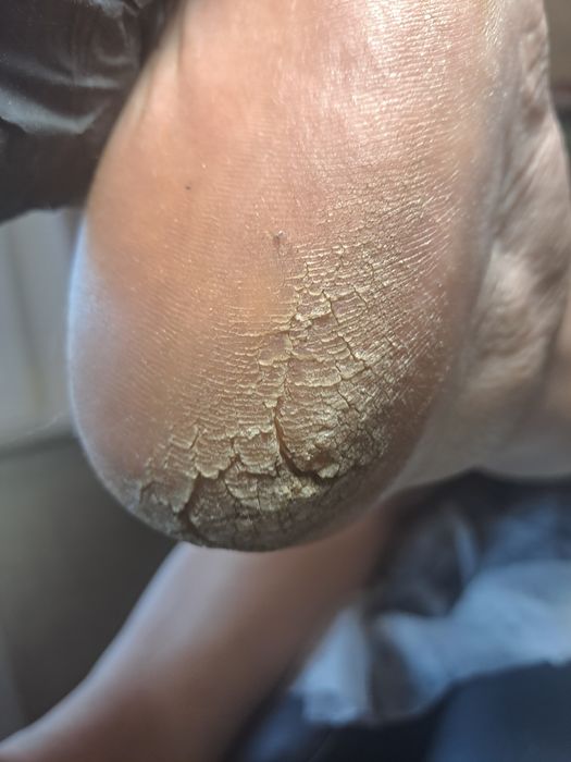 Апаратний педикюр з основами подології в місті СУМИ