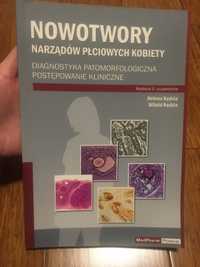 Nowotwory narządów płciowych kobiety