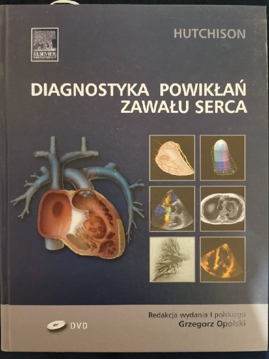 Diagnostyka powikłań zawału serca Opolski Hutchison 2010