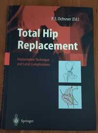 Total Hip Replacement P.E. Oschner - staw biodrowy