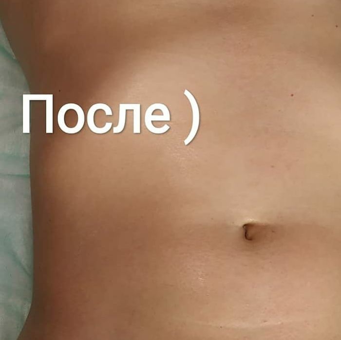 Депіляція для чоловіків Шугарінг Мужская депиляция, шугаринг, эпиляция