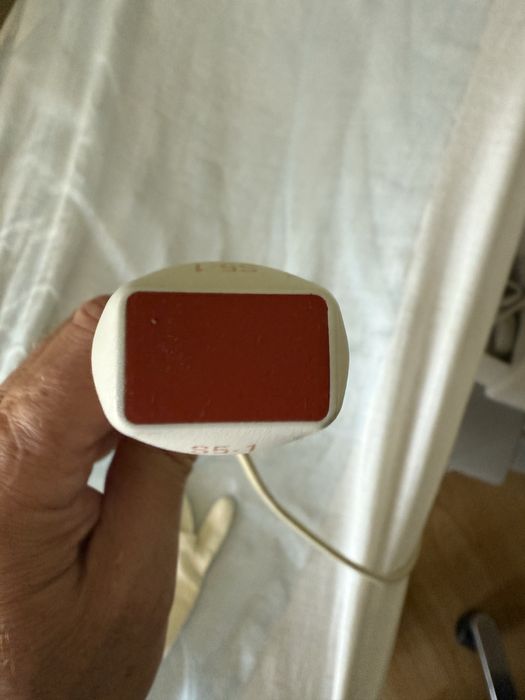 УЗД аппарат експертного класу Philips HD11XE