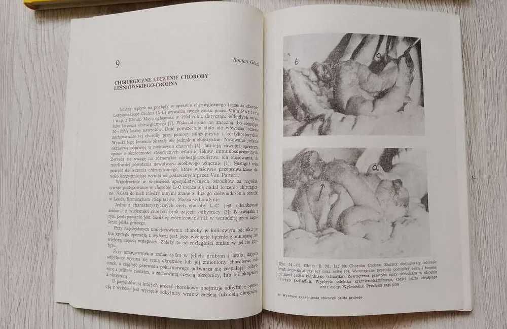 Chirurgia odbytu odbytnicy/ Zagadnienia Chirurgii jelita grubego