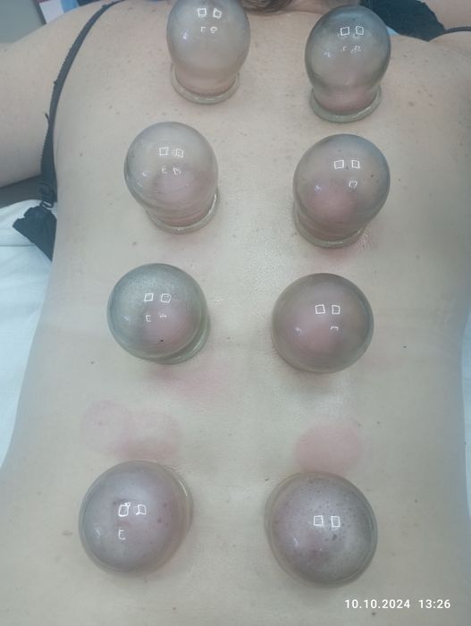 Реабілітолог-масажист. Професійний масаж у Тернополі