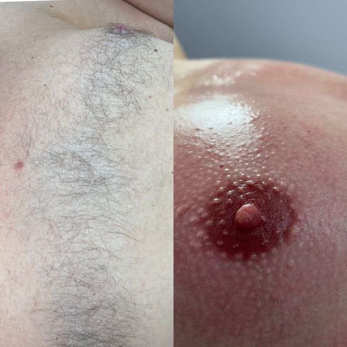 Чоловіча депіляція,шугаринг,віск,електроепіляція,лазерна епіляція Київ