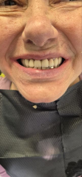 Зубний технік щукає стоматологів