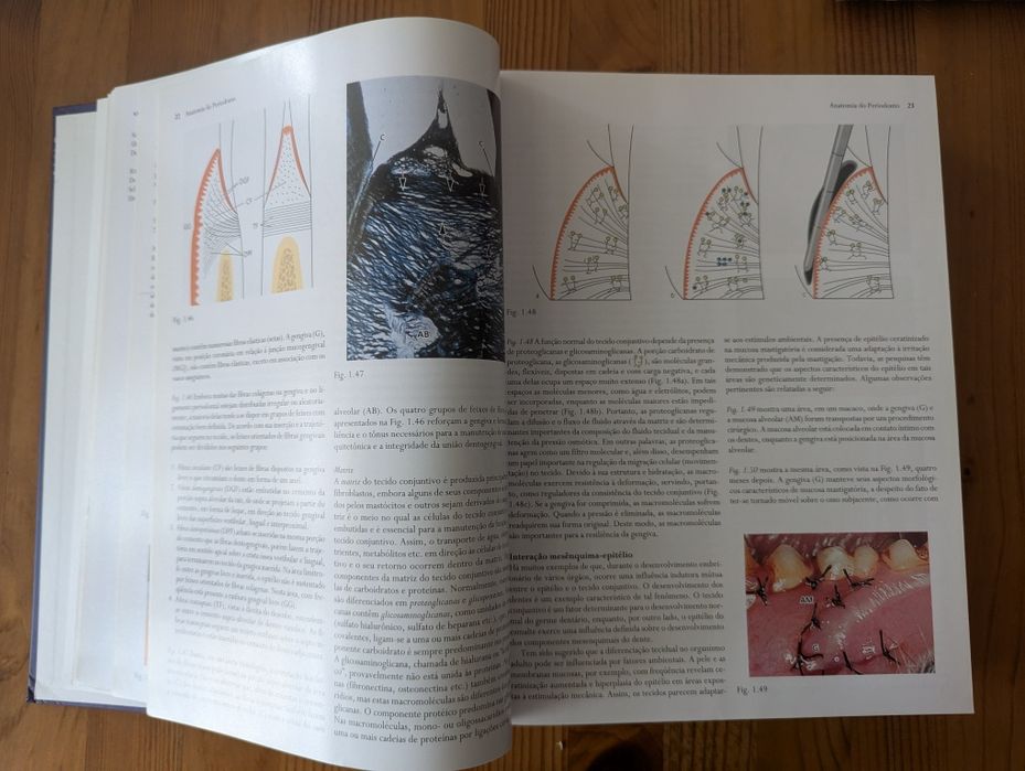 Tratado de Periodontia Clínica e Implantologia Oral - J. Lindhe - 4°ed