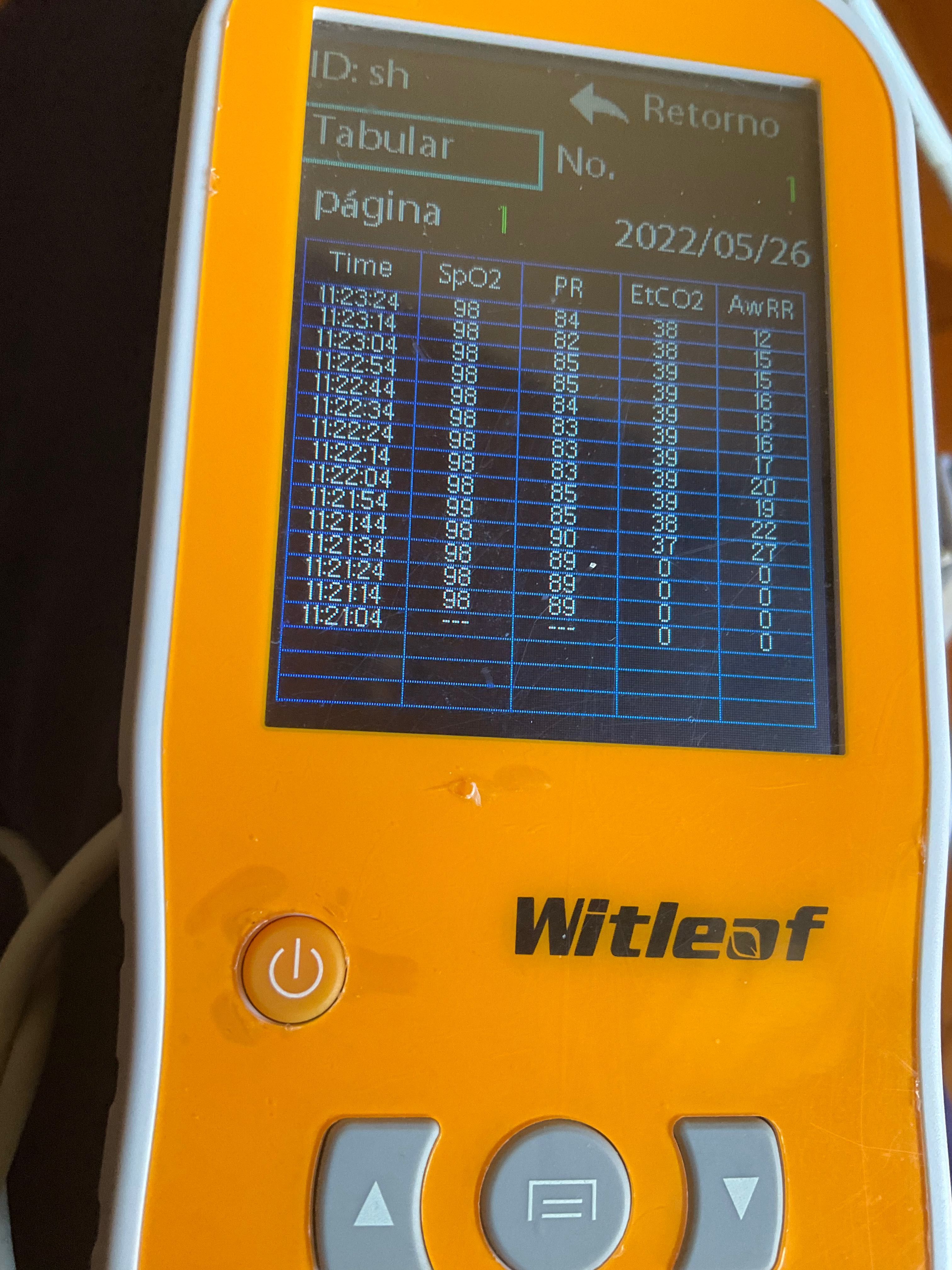 CAPNÓGRAFO COM OXÍMETRO. Medidor de Dióxido de Carbono e Oxigénio.