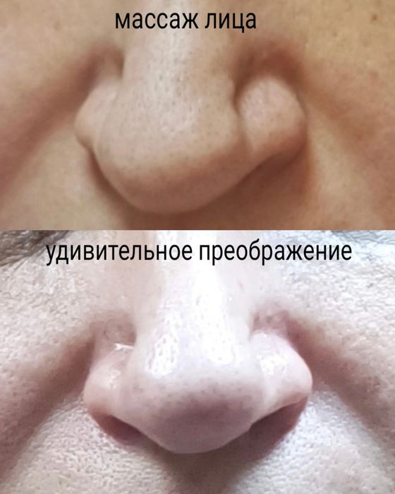 Масаж обличчя  моделюючий,лімфодренажний,міофасціальний м Голосеевская