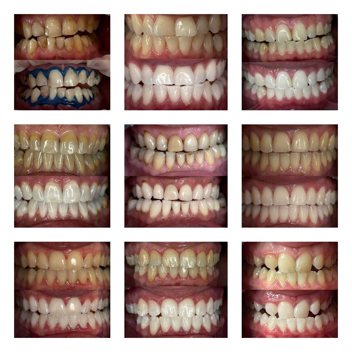 Франшиза сети студий косметического отбеливания зубов Smile LAB