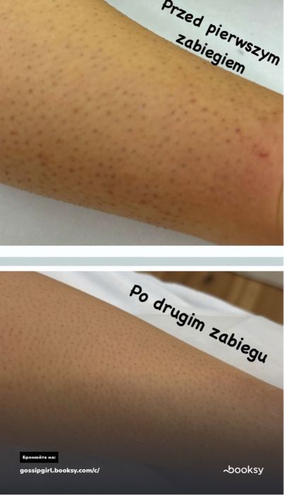 Depilacija Laserowa Centrum Szczecin