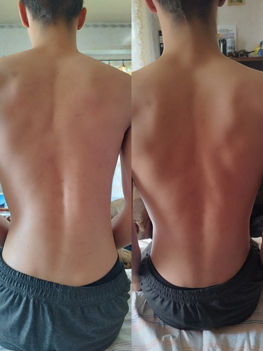 Масаж та реабілітація від професіонала