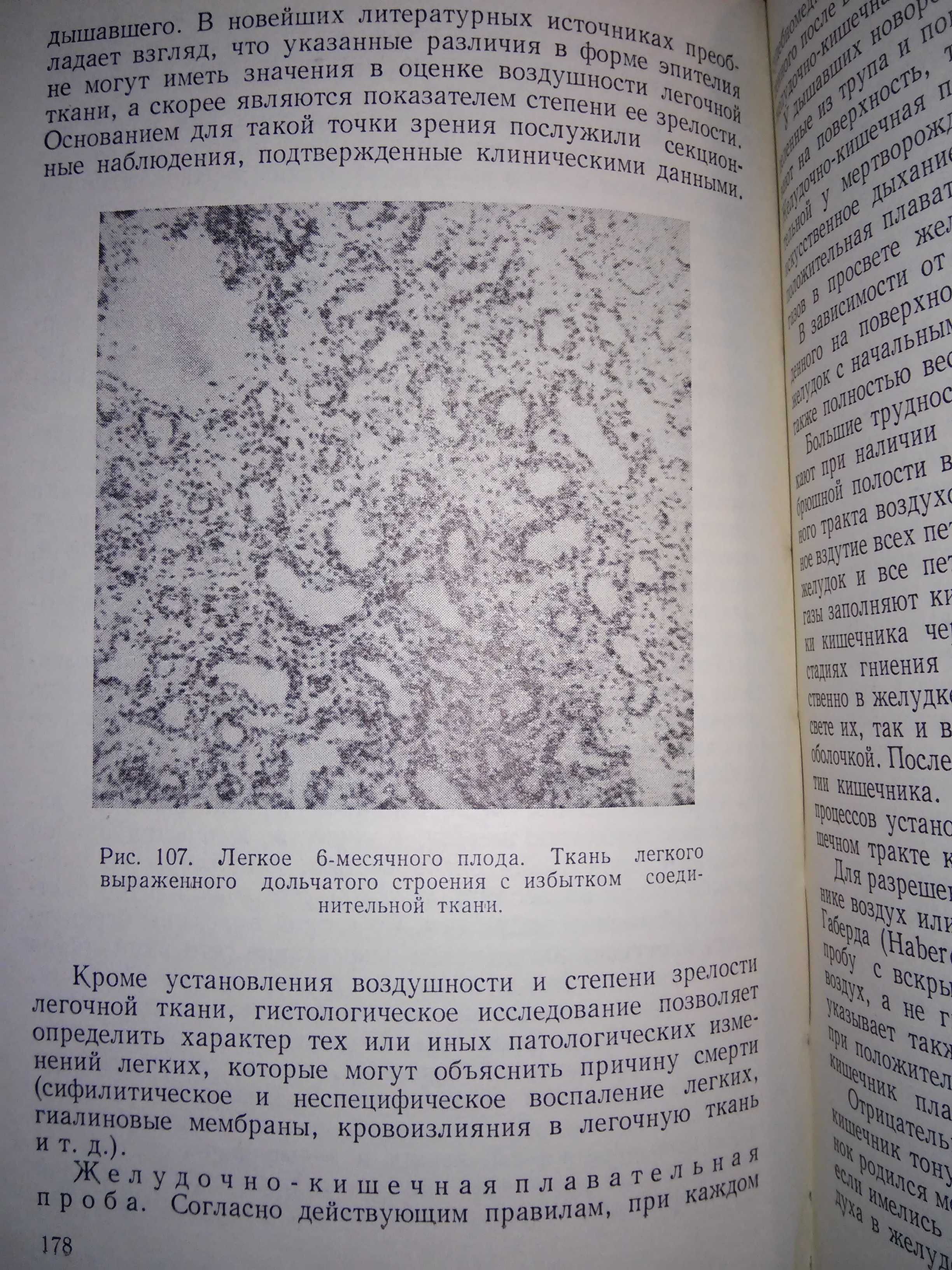 Хрущелевски Секция трупов плодов и новорожденных 1962 р.