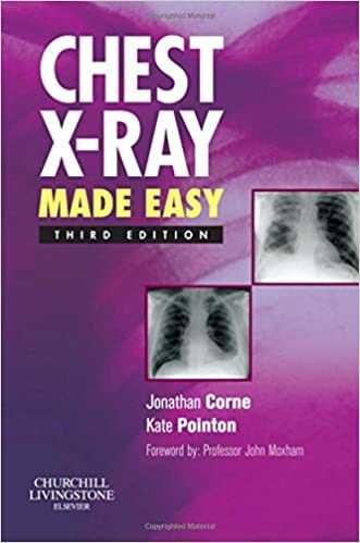 Chest X-Ray Made Easy, 3Ed