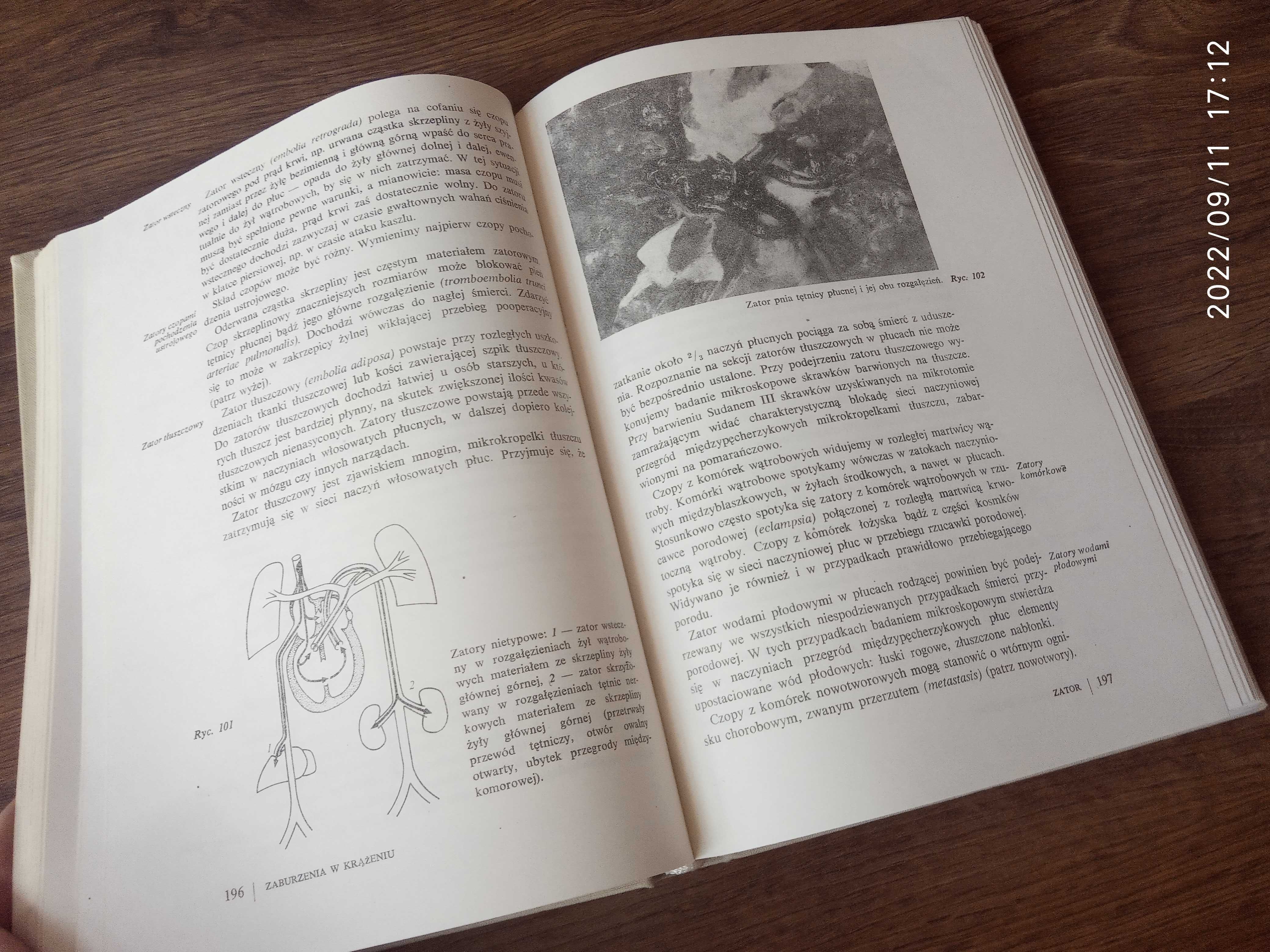 Patomorfologia : podręcznik dla studentów medycyny - J. Groniowski