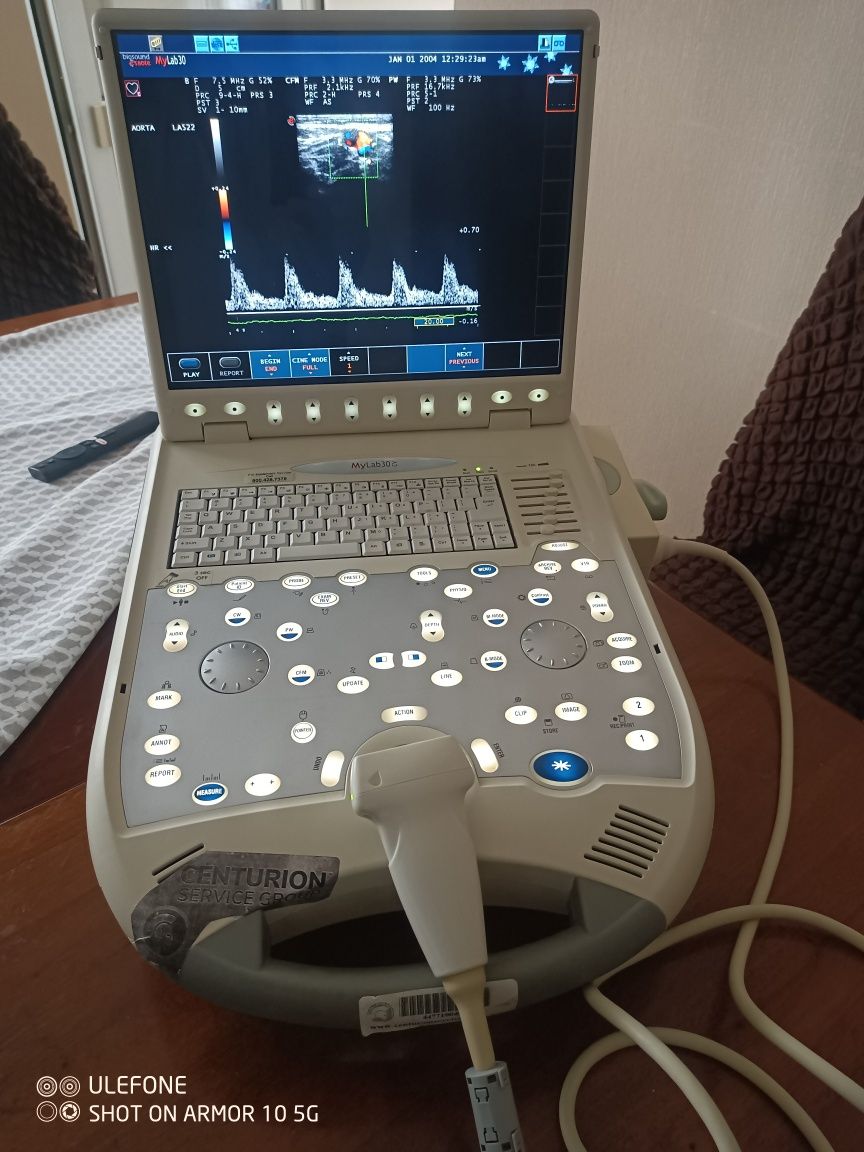 Портативний узд апарат Esaote my lab 30 cv CARDIO УЗИ 2009 р.в.