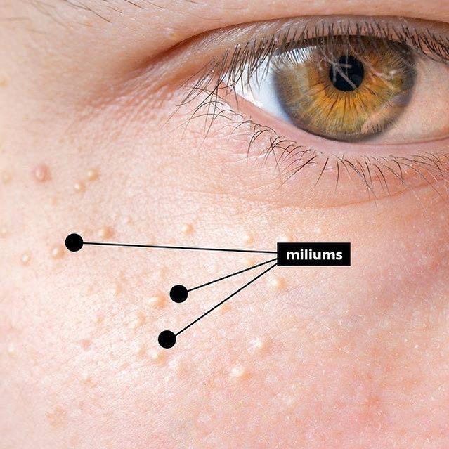 Косметолог, Біоревіталізація, Ботокс, Контурна пластика , мезотерапія.
