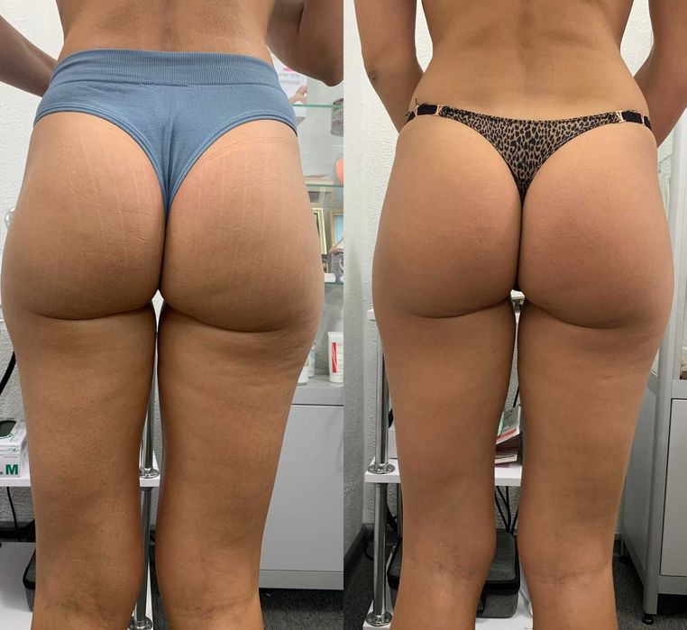 Масаж/Депіляція воском/Апаратний масаж