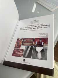 115 clinical cases for implant treatment