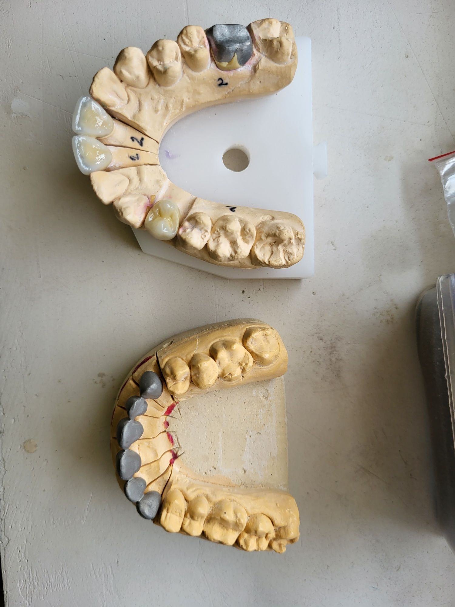 Зуби моделі зубів металокераміка