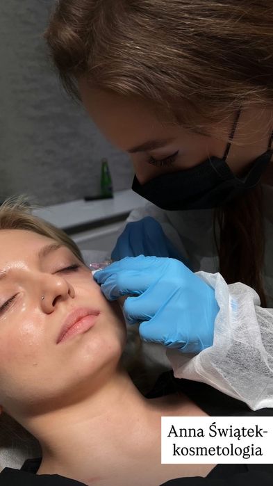 Kosmetolog,Stymulatory tkankowe/mezoterapia igłowa/mikroigłowa/masaż