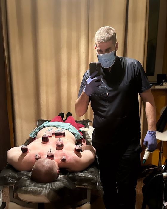 Хіджама - процедура кровоспікання, що прибирає застояну кров