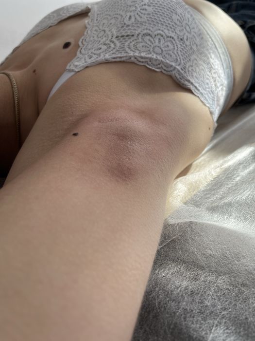 Шугаринг, сахарная депиляция 5 Заречный