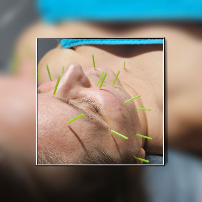 Naturalna Medycyna Estetyczna - akupunkura, masaże twarzy