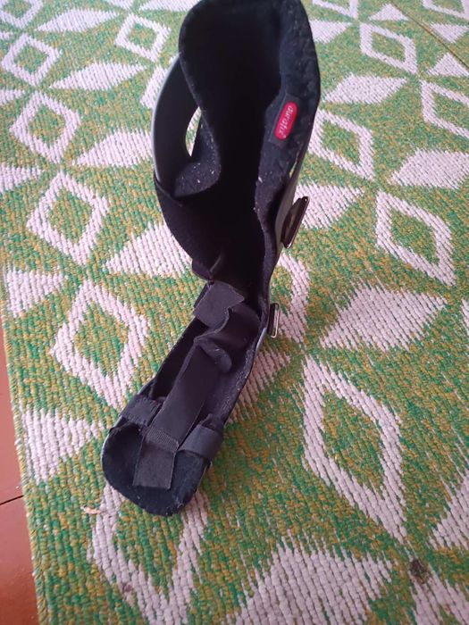 Шина на ногу після перелому