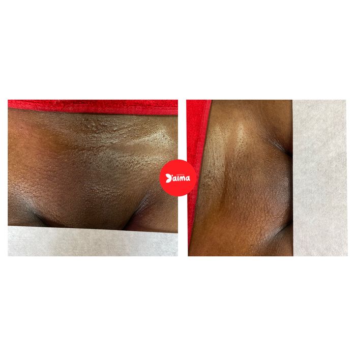 1. Depilação a cera e massagem ao domicílio – Porto e arredores.