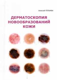 Книга Дерматоскопия новообразований кожи Алексей Гетьман