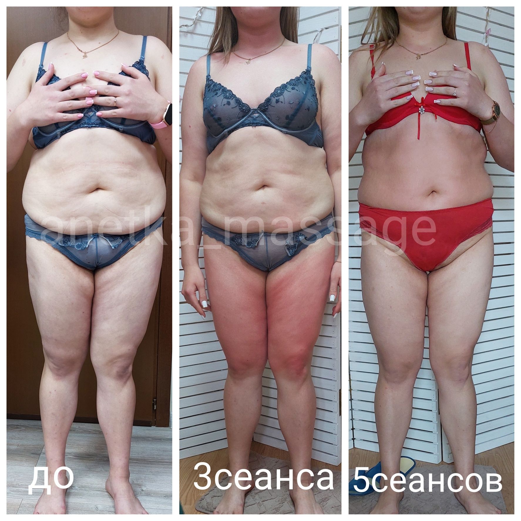 Массаж , антицеллюлитный массаж,  корекция фигуры, вакуумно-роликовый