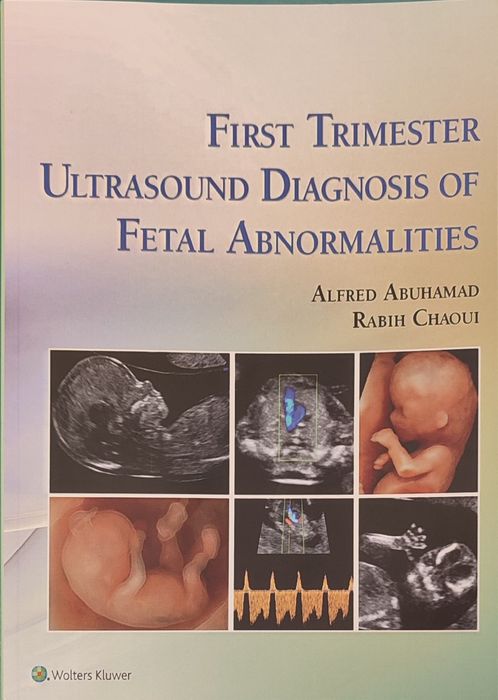 First Trimester Ultrasound Diagnosis of Fetal Abnormalities