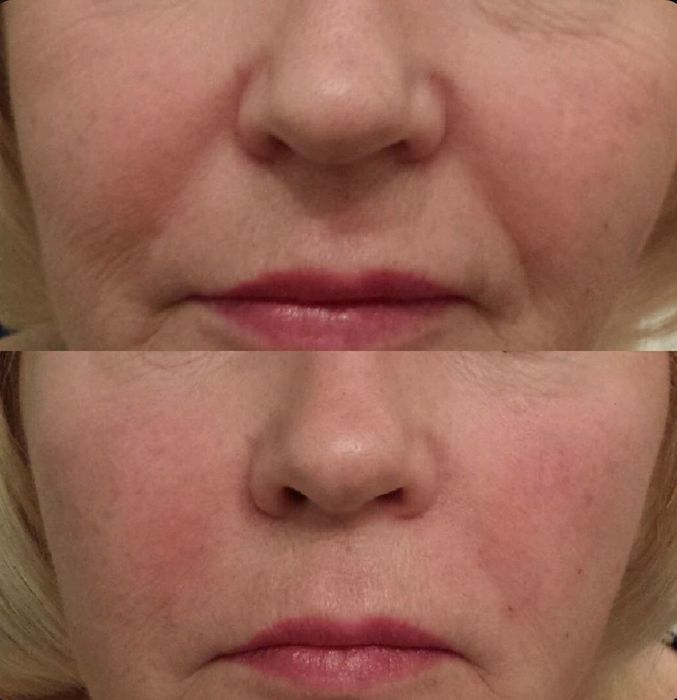 Массаж лица, Массаж, Лечебный, Антицелюлитный, Днепр, Левый берег.